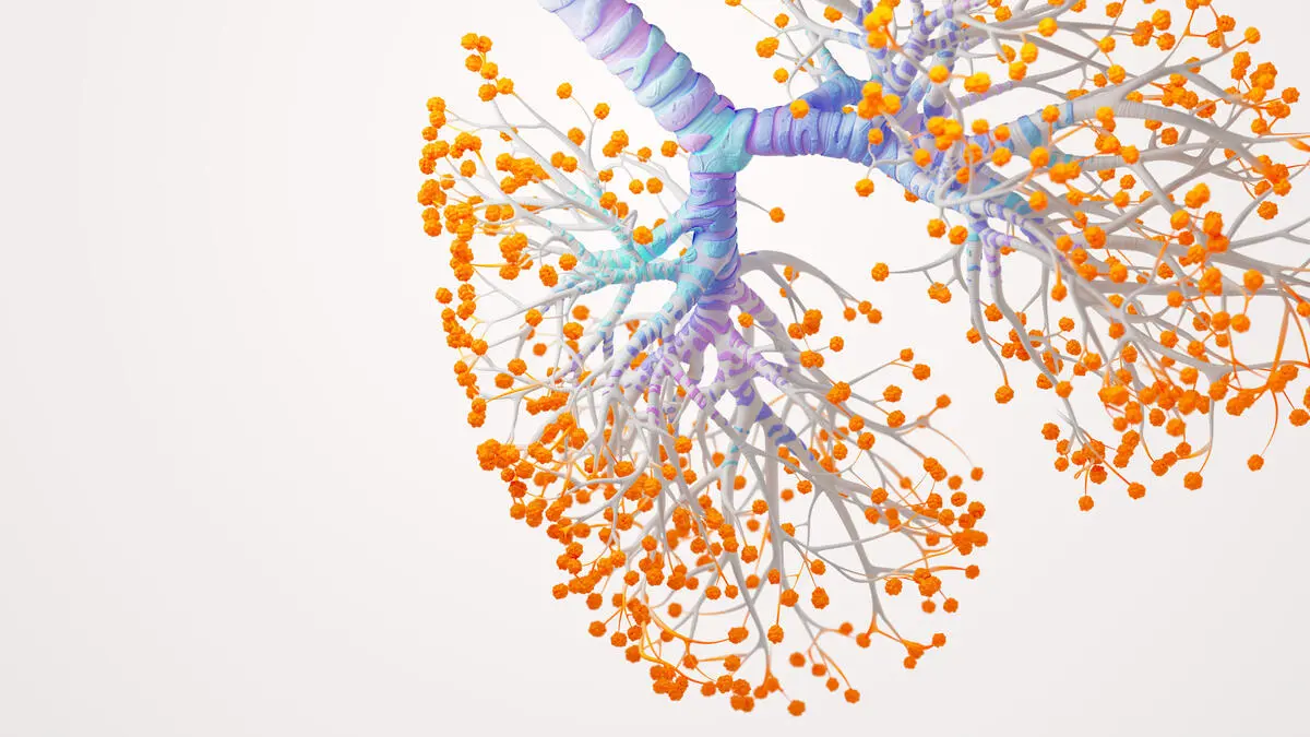Pulmonesepoc
